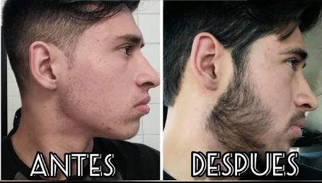 SHAMPOO PARA EL CRECIMIENTO DEL CABELLO Y BARBA For Men®