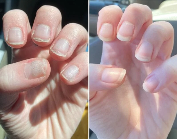 TRATAMIENTO PARA EL CRECIMIENTO DE LAS UÑAS Nail Shield®