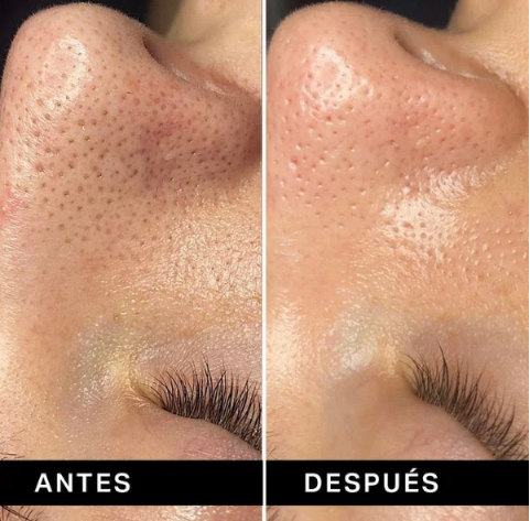 BANDAS PARA ELIMINAR PUNTOS NEGROS DE LA NARIZ Skin Bliss® 🌚