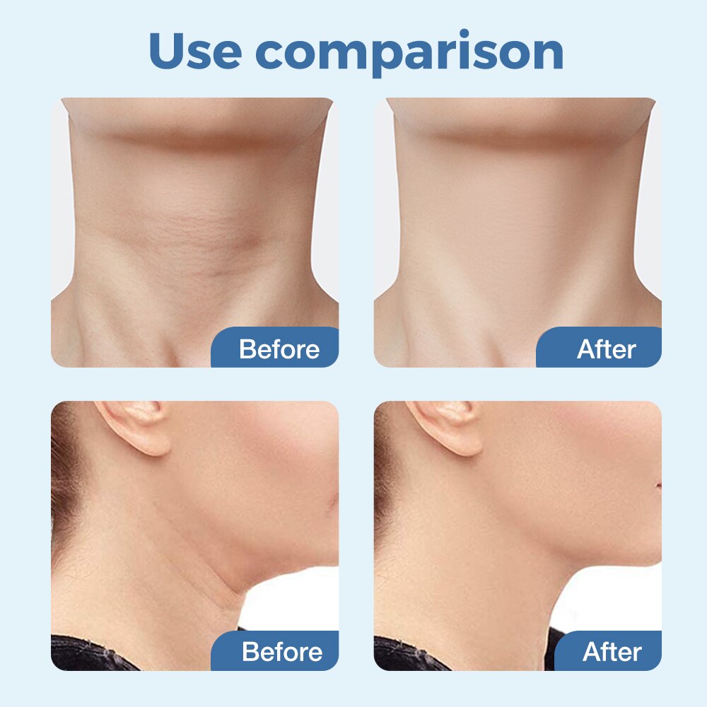 MASAJEADOR FACIAL LED REJUVENECEDOR FOTOTERAPIA Glow Face®