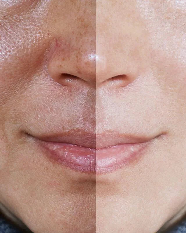 SERUM ANTIMANCHAS Clarity Glow®