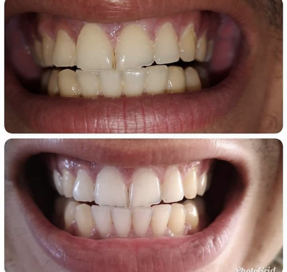 CREMA DENTAL BLANQUEADORA New Skin® 🦷