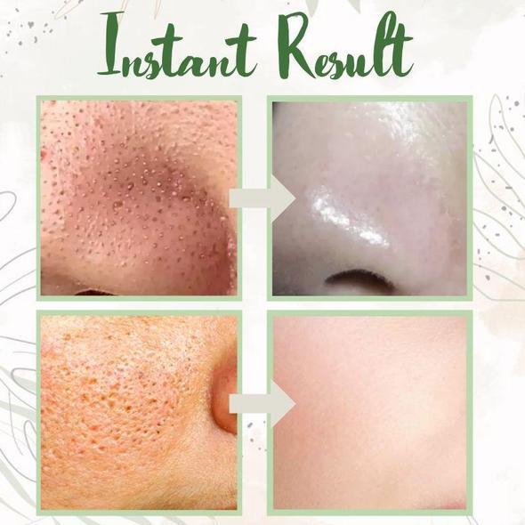 MASCARILLA DE LIMPIEZA PROFUNDA DE TÉ VERDE 🥰