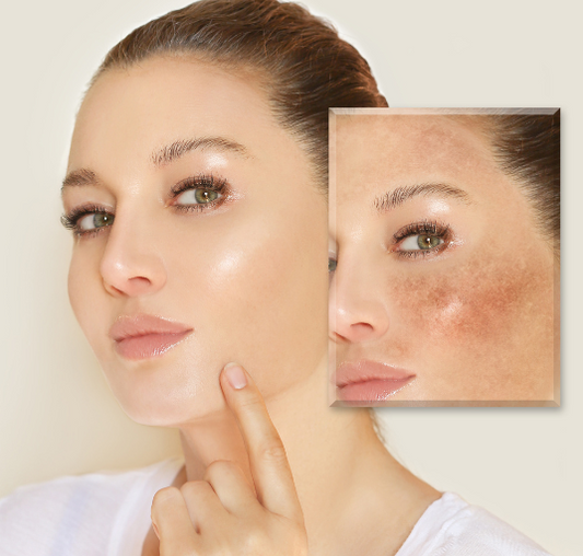 SERUM ANTIMANCHAS Clarity Glow®