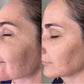 MASAJEADOR FACIAL LED REJUVENECEDOR FOTOTERAPIA Glow Face®