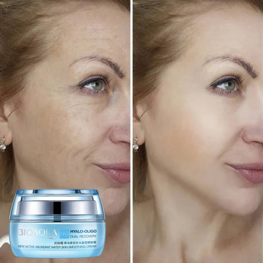 CREMA HIDRATANTE ANTI-EDAD CON ACIDO HIALURONICO Radiance® 💙
