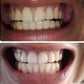 CREMA DENTAL BLANQUEADORA New Skin® 🦷