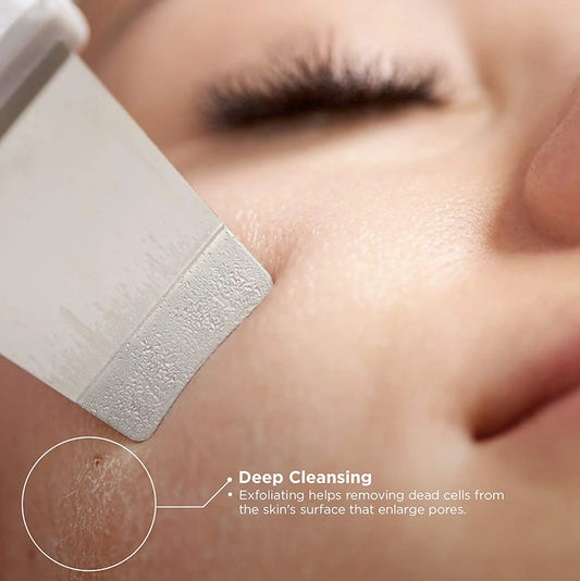 💆🏻‍♀️PEELING ULTRASONCIO FACIAL