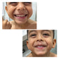 CREMA DENTAL BLANQUEADORA New Skin® 🦷